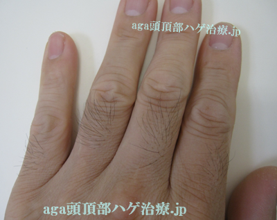 指の毛写真