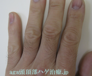手の指毛画像