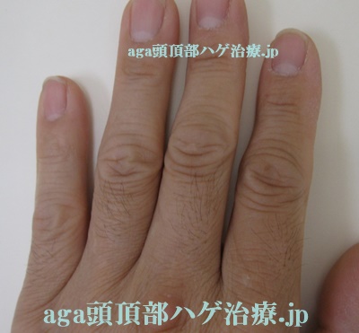 指の毛画像